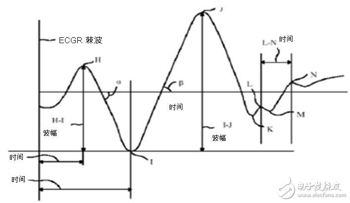 圖二：心臟沖擊掃描圖波形。